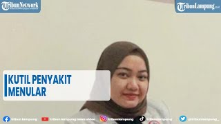 Info Kesehatan Kutil Penyakit Menular TRIBUNLAMPUNGNEWSVIDEO [upl. by Gallager]