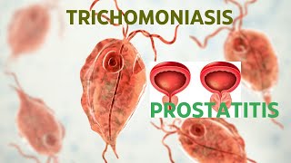 TRICHOMONIASIS ROLE IN PROSTATITIS [upl. by Llerdnod]