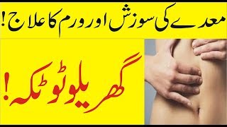 Maidy Ki Sozish or Waram Ka Ilaaj  Aanto ki sozish ka ilaj in Urdu and Hindi  Desi Totika [upl. by Namzzaj926]