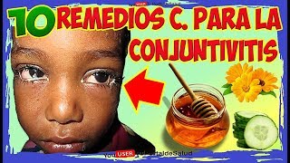 COMO CURAR LA CONJUNTIVITIS con 10 remedios caseros para la conjuntivitis [upl. by Siugram]