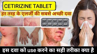 cetirizine hydrochloride tablets ip 10mg in hindi  Cetirizine tablets uses  Allergy Treatment [upl. by Anhoj]