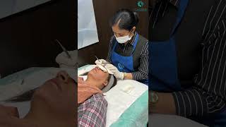 Medical microdermabrasion ghdermacenterhospital2196 ghderma acnetreatment acnescarremoval [upl. by Belcher]