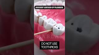 flossing toothpicks oralhygiene dentalcare dentist dentistry nablas pattambi [upl. by Modesty]