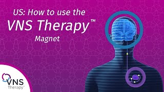 How does VNS Therapy work [upl. by Comethuauc]