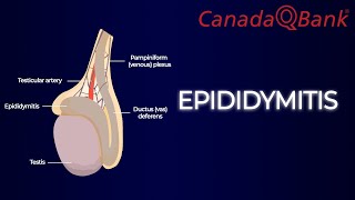 Epididymitis [upl. by Tye153]