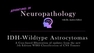 IDH  Wildtype Astrocytoma Update from the 5th Edition WHO Classification of CNS Tumors [upl. by Anoiuq]