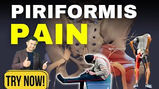 Top 3 Exercises for Piriformis Syndrome Pain Relief MUST TRY [upl. by Giorgio]