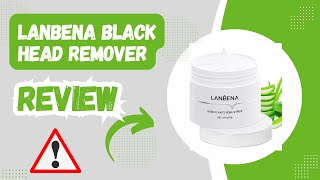 LANBENA Blackhead Remover Review Does It Really Work [upl. by Linette390]