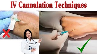 How To Insert IV Cannula  IV Cannulation Techniques [upl. by Couchman]