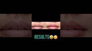 Pigmented lips packdesinuskha homeremedies beauty followformore 😊🙏 [upl. by Notnilc]