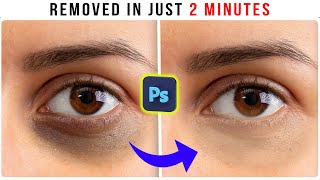 how to remove dark circle or pimple in photoshop  Remove deep dark circles in photoshop [upl. by Assitruc]