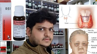 thyroid homeopathic medicine for hypothyrodism thyroid problem in women explain [upl. by Lopes]