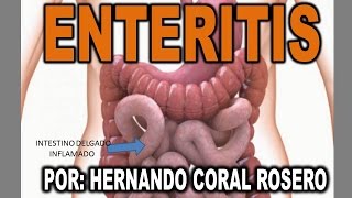 ENTERITIS  INFLAMACIÓN DEL INTESTINO DELGADO [upl. by Sakhuja]