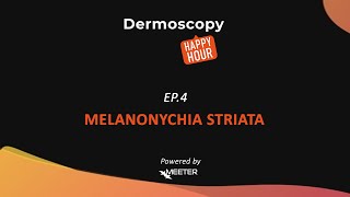 Dermoscopy Happy Hour  SEASON 2 EPISODE 4 quotMELANONYCHIA STRIATAquot [upl. by Yendyc400]