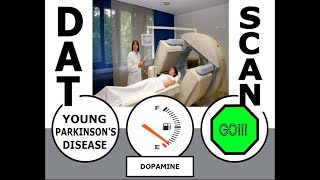 DATScan News Clip  DATScan reveals an Early Parkinson Diagnosis DATScan YoungParkinsons [upl. by Janel500]