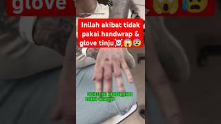 Jgn coba² gk pake glove klo GK mau kek gini ☠️😰 boxing boxingskill fight mma bangghalyh [upl. by Lennahs147]