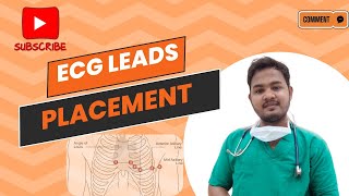 ECG Leads placement ECG electrode placement  EASY EXPLANATION ECG TYPES OF ECG LEADSecg [upl. by Past]