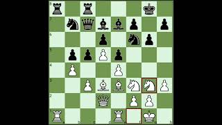 GM Anatoly Karpovs Best Chess Games Ever  Karpov vs Unzicker 1974 [upl. by Amat194]