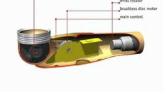 Otto Bock Dynamic Arm [upl. by Aleit]