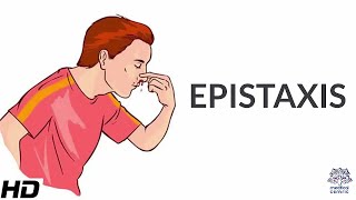 Epistaxis Causes SIgns and Symptoms Diagnosis and Treatment [upl. by Nwahsauq]