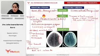 ENFERMEDAD CEREBROVASCULAR PARTE 3  NEUROLOGÍA  VILLAMEDIC [upl. by Sheena]