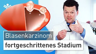 Blasenkrebs im fortgeschrittenen Stadium Wann muss die Blase entfernt werden [upl. by Kaehpos]