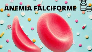 Anemia Falciforme [upl. by Kuth]