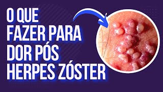 Herpes Zóster  Tratamento Para Dor Pós Herpes Zóster [upl. by Gaidano538]