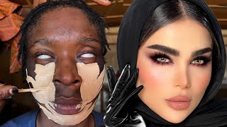 A Blind Girl Got Transformed Into This 😳👆🔥Unbelievable Makeup Transformation 🔥💉😳🔥😱 Makeup Tutorial [upl. by Nannie413]