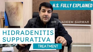 HS Hidradenitis Suppurativa Homeopathic Medicines and Treatment Explained  Dr Nadeem Sarwar [upl. by Dnivra656]