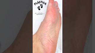 Plástica dos pés 👣 Linha Sebo de Carneiro Nati Cosmética spadospes pedicure plástica [upl. by Enrev711]