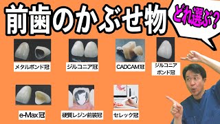 【前歯のかぶせ物７選】長持ちする歯、美しい歯はどれ？ おすすめ治療法を歯医者が解説 [upl. by Nysa]