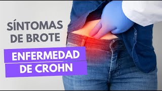 Cómo saber si estás en brote de Enfermedad de Crohn  Descodificando los síntomas [upl. by Ybsorc504]