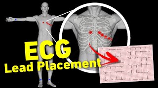 ECG lead placement MADE EASY  12 lead ECG placement  How to perform ECG • Daily Cardiology [upl. by Tenner]