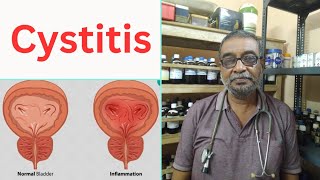 Cystitis  DrAniruddhaDe [upl. by Dearborn]