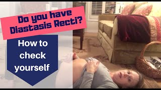 How to check yourself for Diastasis Recti [upl. by Shandy]