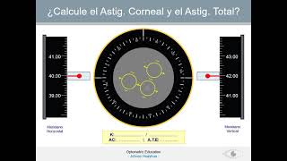 KERATOMETRY  QUERATOMETRIA  SESIÓN PRÁCTICA PPT [upl. by Eirrahs]