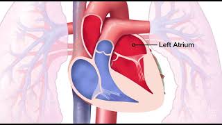 Mitral Valve Regurgitation [upl. by Annoek646]