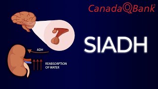 SIADH Syndrome of Inappropriate Antidiuretic Hormone Secretion [upl. by Reich51]