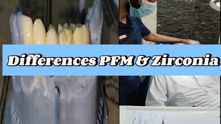 Difference porcelain amp Zirconia CrownPFM Crown CementationPorcelain Crowns Front teethPFM [upl. by Nosyla]