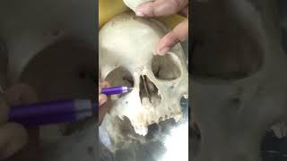 Frontal bone anatomy partsfeatureattachment etc [upl. by Eenafets563]