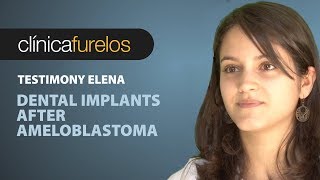 Elena Dental implants after ameloblastoma LOC [upl. by Ecilayram529]