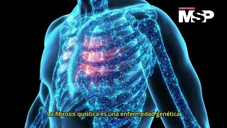 ¿Cómo actúa la fibrosis quística  ExclusivoMSP [upl. by Turmel935]