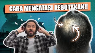 CARA MENGATASI KEBOTAKAN DINI DAN MERAWAT RAMBUT RUSAK [upl. by Siron]