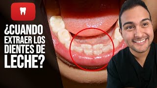 DIENTES DE LECHE ¿CUANDO COMO Y PORQUE SE CAEN ¿HAY QUE SACARLOS 38 [upl. by Swords]