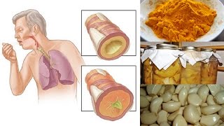 Natural Remedies for Chest Congestion Relief [upl. by Olag]