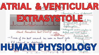 ATRIAL extrasystole Ventricular Extrasystole compensatory pause CVS [upl. by Clayson]