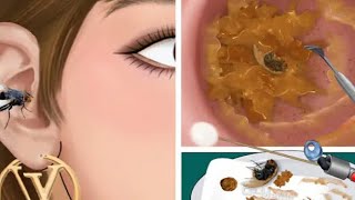 Watching is Addicted Ear WaxRemoval ASMR Close Up Latest EarCleaning asmr earwax earwaxremoval [upl. by Anairad]