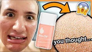 I tried BIO OIL on my face for ONE WEEK my mom really thought this was a miracle oil lol [upl. by Jezabelle372]