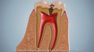 Le Canal Radiculaire dentaire [upl. by Naujed]